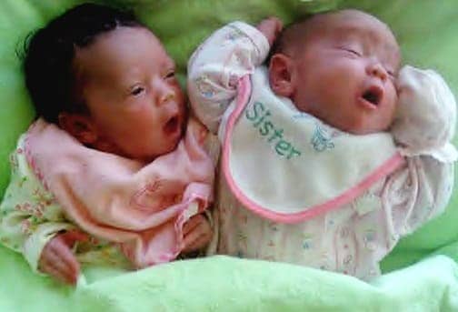 Black Infant Health twins Trinity and Serenity Chambers at birth.