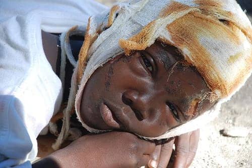 Haiti-earthquake-injured-boy-011510-by-Eric-Quintero-IFRC, A cry for help from Haiti: ‘They are cutting off limbs needlessly and taking our dignity; the babies need to eat tonight’, World News & Views 